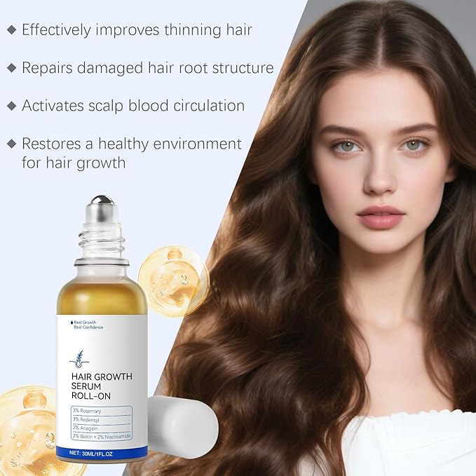 30ml Hair Growth Serum Roll-On for Thinning Hair – Stimulates Follicles, Strengthens Roots & Boosts Density with Rosemary & Biotin – Non-Greasy Scalp Treatment for Men and Women