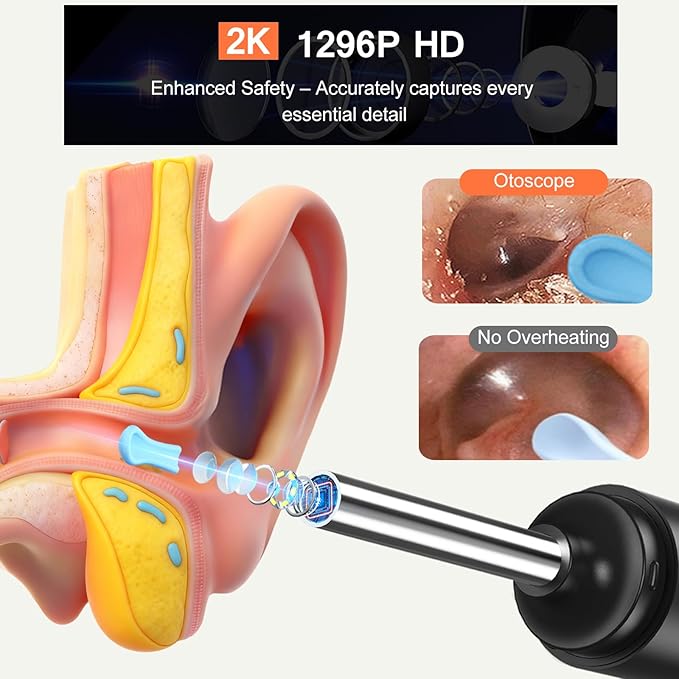 2-in-1 Visual Ear Wax Removal & Nose Hair Trimmer, 1296P HD Ear Cleaner with AI Eardrum Alert, Smart Anti-Pinch, 360° Rounded Blades, IP67 Waterproof, APP Visual Camera for Men, Women & Family Use