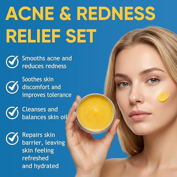 2PCS Acne & Redness Killer, Acne Set for Healthy Skin, Facial Cream With Marigold, Thistle, Lavender, Beeswax, Sea Buckthorn, Vitamin E - For All Skin Types Men & Women