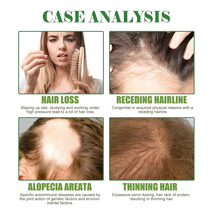 Rosemary Mint Scalp & Hair Strengthening Oil, Natural Ingredients with Jojoba Oil, Anti-Hair Loss Treatment for All Hair Types, 2.02 fl oz Glass Bottle with Dropper
