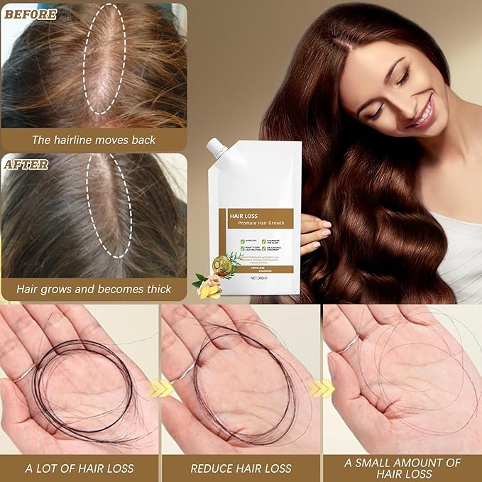 Anti-Hair Fall Hair Loss Shampoo, Promote Hair Growth Shampoo, Rich in Various Plant Extracts, for All Hair Types (300ml / 1 Bottle)