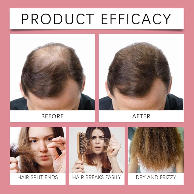 50ml Hair Strength Spray - Promotes Healthy Hair Growth, Repairs Follicles, Deeply Nourishes Scalp & Hair, Reduces Breakage, With Glycerin & Tocopherol