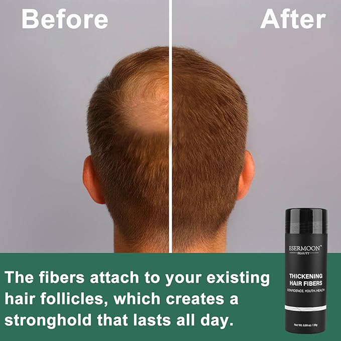 Hair Fibers (28g), Hair Fibers for Thinning Hair, Hair Building Fibers, Hairpiece Filler, Increase Hair Density, Styling Powder for Women & Men, Hair Makeup, Premium Formula Thickening (DARK BROWN)
