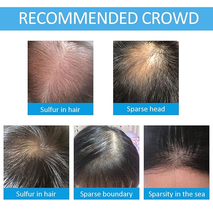 Hair Building Fibers for Thinning Hair with Spray Applicator Pump Nozzle - Natural & Undetectable,Instantly Thicker Fuller Hair Conceals Hair Loss 30 Sec,4 Shades for Men & Women,27.5g (Dark Brown)