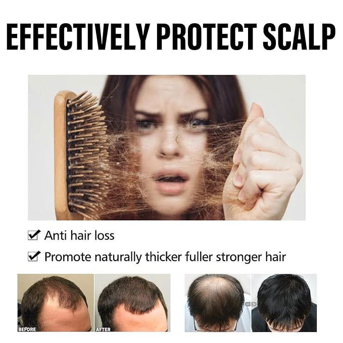 30 Count Hair Regrowth Capsules - Accelerate Hair Growth & Thicken Hair by 50-85% - Scalp Stimulating Herbal Extracts with Argan Oil & Vitamin E