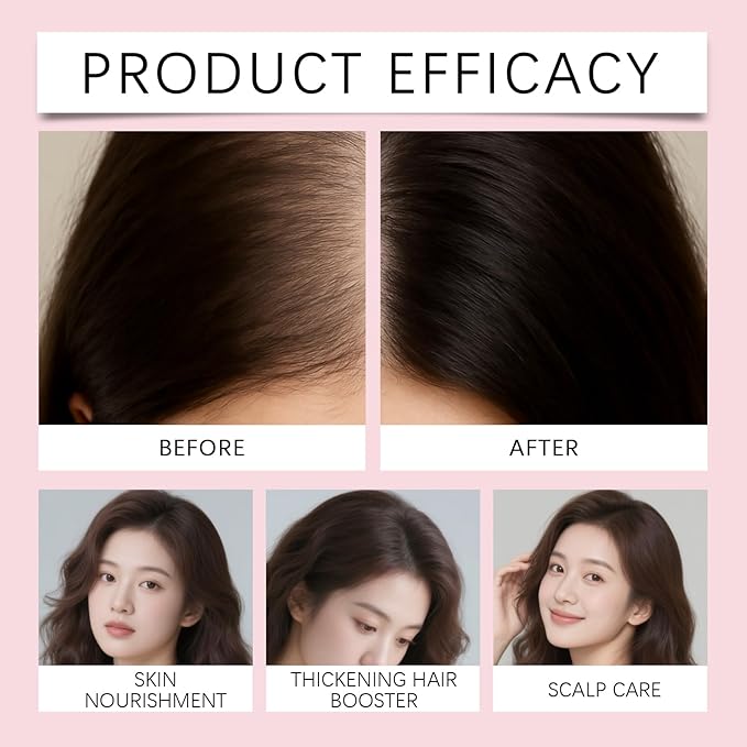 28ml Hair Reawaken Roll-On Serum for Thinning Hair – Nourishes Scalp & Strengthens Hair Follicles to Promote Fuller, Voluminous Hair Growth
