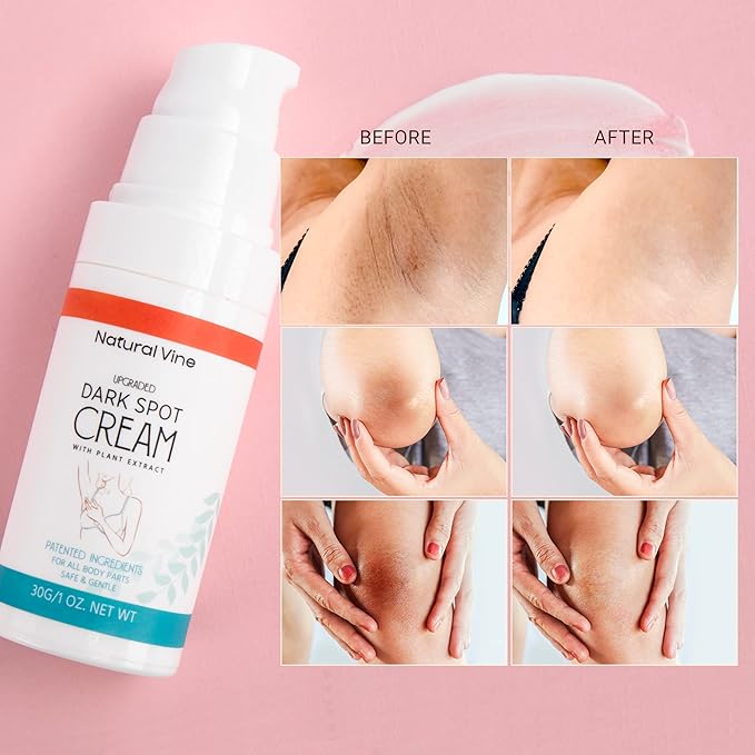 Natural Vine Dark Spot Corrector Cream: Dark Spot Remover for Body in 4-8 Weeks - Instant Concealing & Age Brown Sun Faded Spot Remover Melasma Freckles Correcting with Niacinamide, 1 OZ/30g