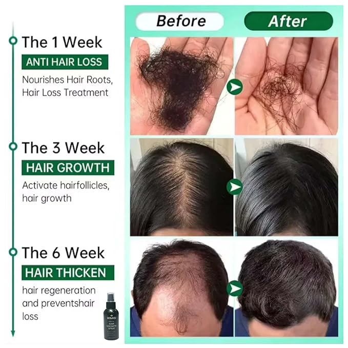 Hair Tonic Spray, Tónico para Cabello, Herbal Ginseng Hair Mist with Biotin & Keratin, Lightweight Daily Hair Care, Nourishing and Hydrating Spray for Men & Women, Non-Greasy Hair Strengthening Mist