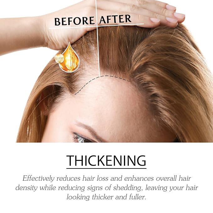 2ml Hair Growth Serum for Thinning Hair & Hair Loss - 7 Count Hair Strength Pro Ampoules with Biotin, Jojoba Oil, Rosemary & Vitamin E - Scalp Treatment to Reduce Shedding & Thicken Hair