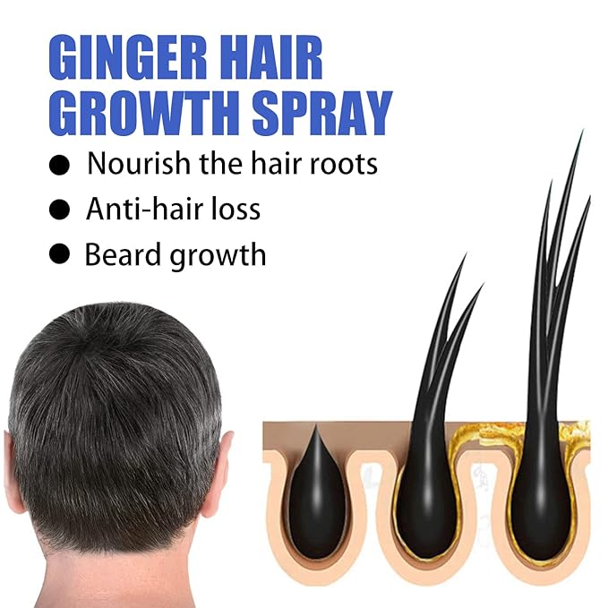 Ginger Hair Growth Spray for Men & Women, 30ml Anti-Hair Loss Treatment, Scalp Nourishing & Follicle Activation, Natural Ginger Extract for Thicker & Fuller Hair