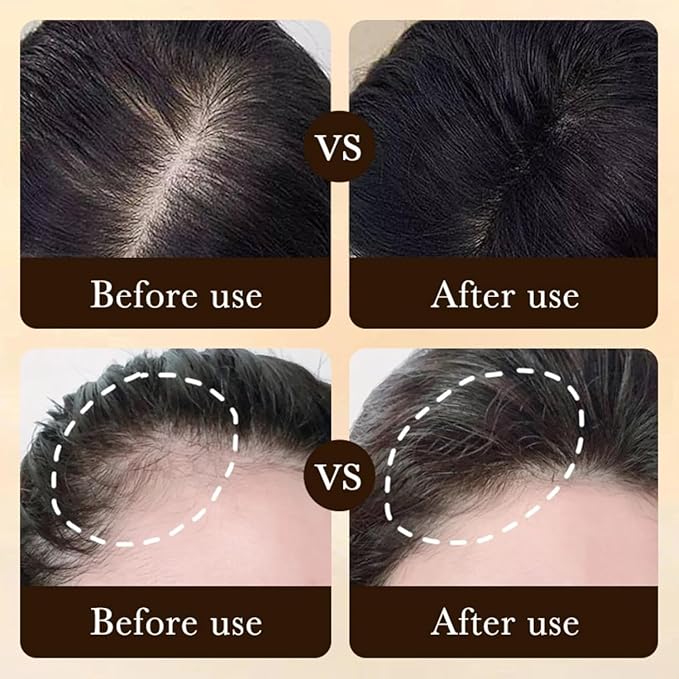 Hair Growth Serum Designed for Black Women with Herbs and Natural Vitamin (2 Pcs)