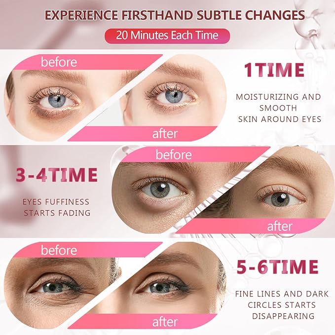 2 Packs 60 Pcs Under Eye Patches, Pink+Green, 30 Pairs Women Undereye Mask for Puffy Eyes Dark Circles Treatment, Men Collagen Gel Pads Hydrating for Eye Bags Puffiness Wrinkle, Beauty Skin Care