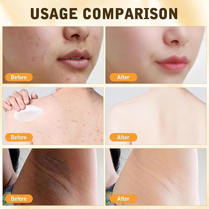 Bee Venom Comprehensive Cream, 2025 New Skincare Treatment Bee Venom Skin Cream, Visibly reduces skin blemishes, Natural Skin Moisturizer for Face and Body