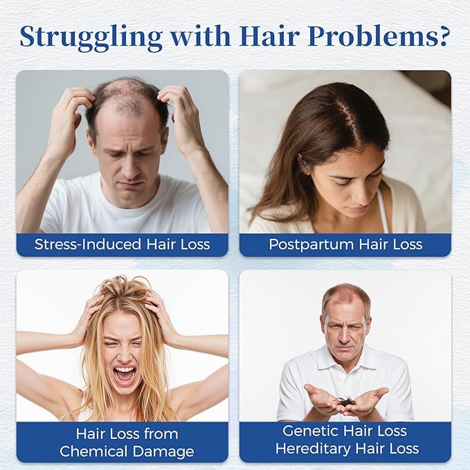 Hair Growth Serum Roll On with Rosemary，Helps Support Thicker, Fuller Hair Appearance，Clean, Non-Greasy Hair Loss Support for Men & Women，Rosemary，0.84 Fl Oz (Pack of 1)