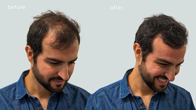 Hair Building Fibers - Volumizing Hair Fibers with real Keratin for Thinning Hair/Hair Loss Dermatologist Tested and Certified Hypoallergenic - 60 days + supply (Blond)