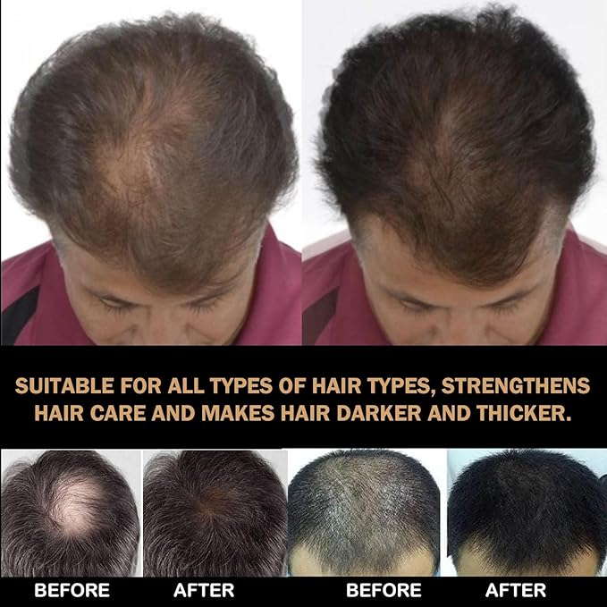 Root Activator Shampoo for Men: Hair Growth Shampoo for Hair Loss and Thinning Hair, For Anti-Hair Loss, Natural Regrowth Formula for Men and Women - 6.7 fl oz / 200 mL