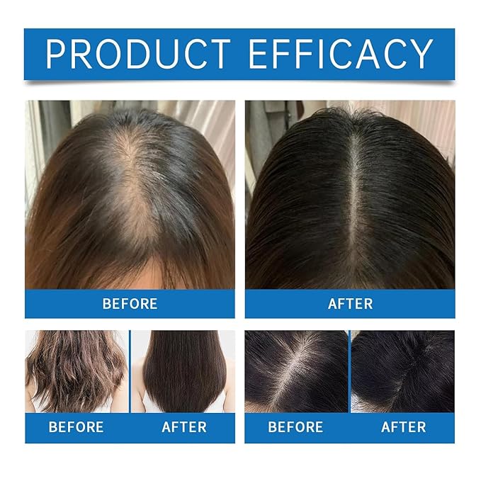 Hair Care Serum Roll On, Nourishing Scalp & Hair Treatment for Growth, Leave-In Rollerball Essence for Dry, Damaged Hairs 10ML (3pcs)