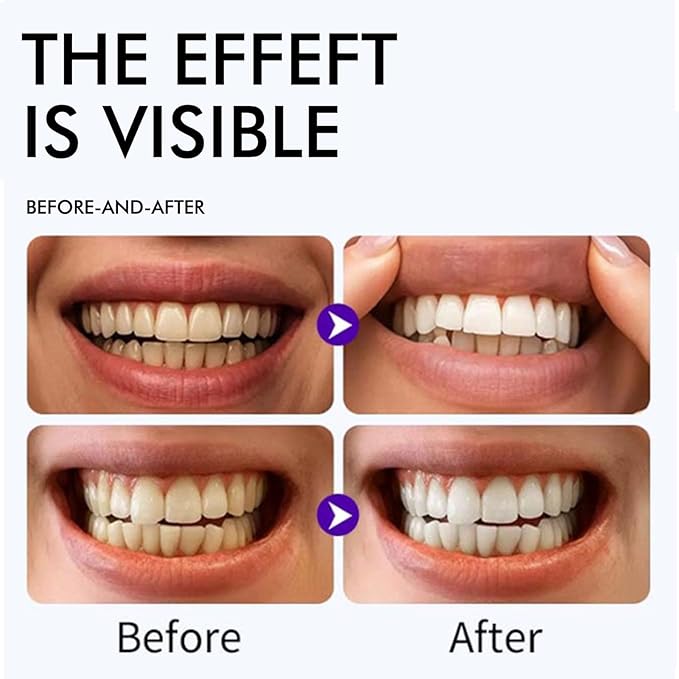 Purple Teeth Whitening Strips, Gentle Daily for Surface Stain Reduction & Natural Shine, Whitening Strips Portable for Home or Daily Use, 14 Strips