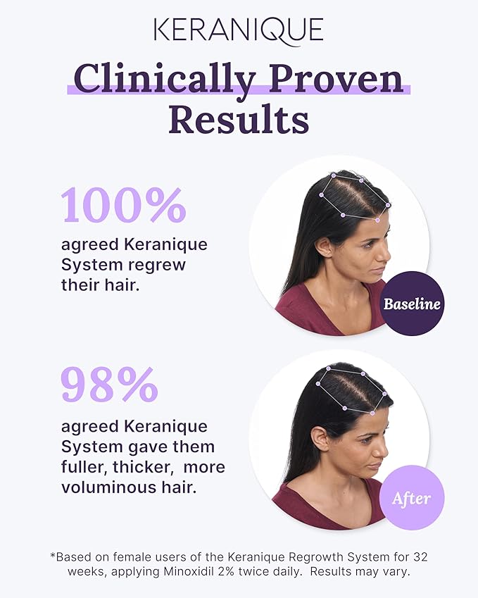 Keranique Women's 5% Topical Minoxidil Foam – Hair Regrowth Scalp Treatment with Powerful NutriGrow blend - Supports Thicker, Fuller, Healthier Hair & Scalp p - 2 Month Supply