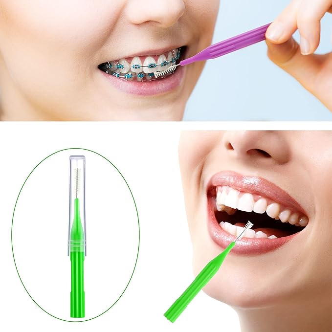 Patelai 50 Pieces Braces Brush for Cleaner Interdental Brush Between Teeth Toothpick Flosses Dental Flossing Head Oral Hygiene Tooth Cleaning Tool (Assorted Color)