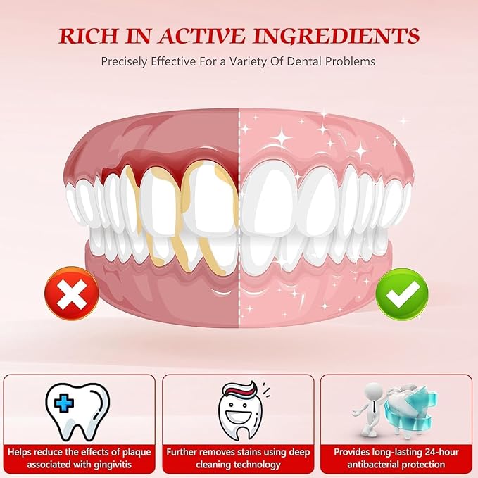 SP-6 Probiotic Whitening Fluoride Free Toothpaste, Upgraded Formula | Ultra Brightening | Gums & Enamel Repair | Mint Flavor | Removes Stain & Plaque | Sensitive Teeth Protection