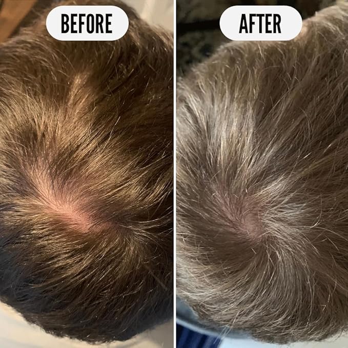 Noughty 97% Natural Get Set Grow Tonic, Leave in Treatment for Thicker and Fuller Looking Hair, with Pea Complex and Hyaluronic Acid 2.5fl.oz