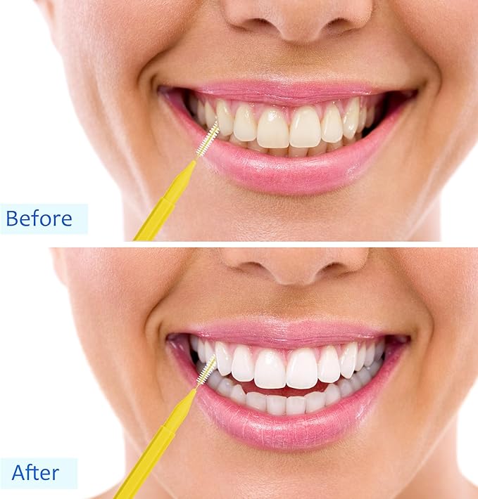 Patelai 100 Pieces Braces Brush for Cleaner Interdental Brush Toothpick Dental Tooth Flossing Head Oral Dental Hygiene Flosser Toothpick Cleaners Tooth Tool(Blue, Yellow,Multiple Sizes)