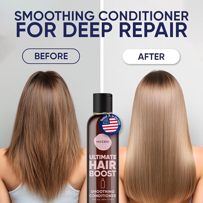 Moerie Hair Growth Conditioner for Men and Women, Hair Loss Solution with Biotin and Rosemary, Thickening Conditioner for Thinning Hair – Ultimate Boost for All Hair Types