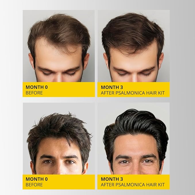 Hair Growth Shampoo and Conditioner Set: Sulfate Free Hair Growth Root Activator Thickening Shampoo for Hair Loss and Thinning Hair - Hair Loss RegrowthTreatments for Women Men