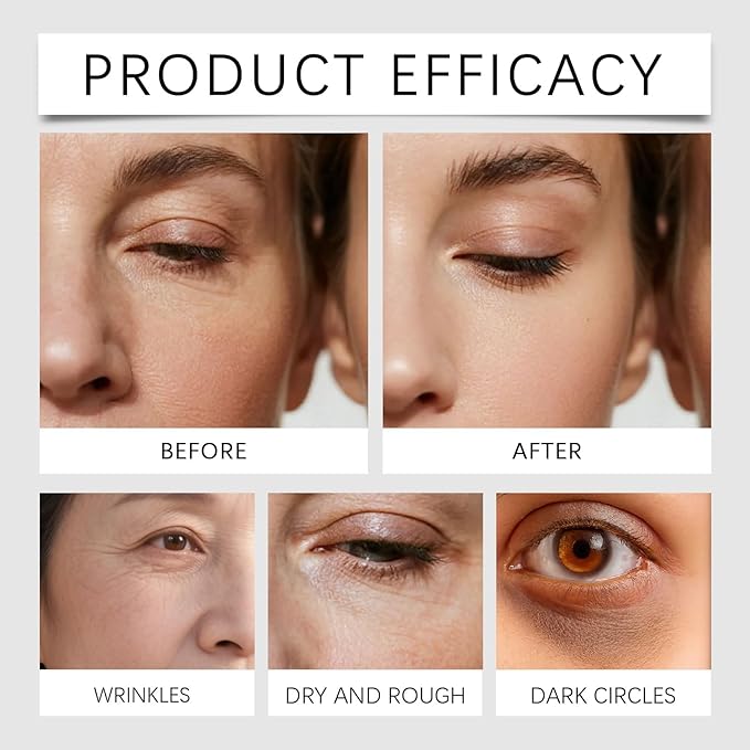 Eye Patches Masks, Calcium Volume Eye Patches For Under Eye Puffiness, Collagen Deep Hydrating Eye Treatment For Men & Women(60 Patches) (1)