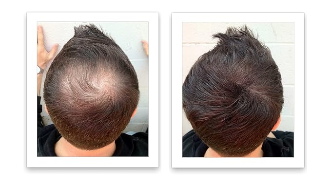 Caboki Hair Fibers for Thinning Hair – Natural Plant-Based Hair Powder for Men & Women – Instantly Thicker Fuller Looking Hair – Wind & Sweat Resistant – 30g, 90-Day Supply, Dark Brown