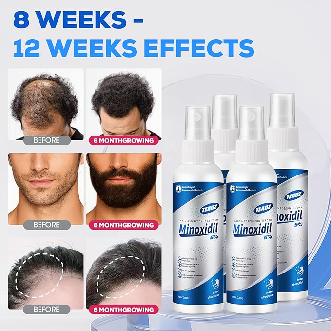 5% Minoxidil for Men and Women，Minoxidil hair growth products，Intense Hair Growth Serum，May Promote Faster, Stronger, Thicker Hair Growth to Fight Hair Loss and Thinning Hair（2.82 oz*4）