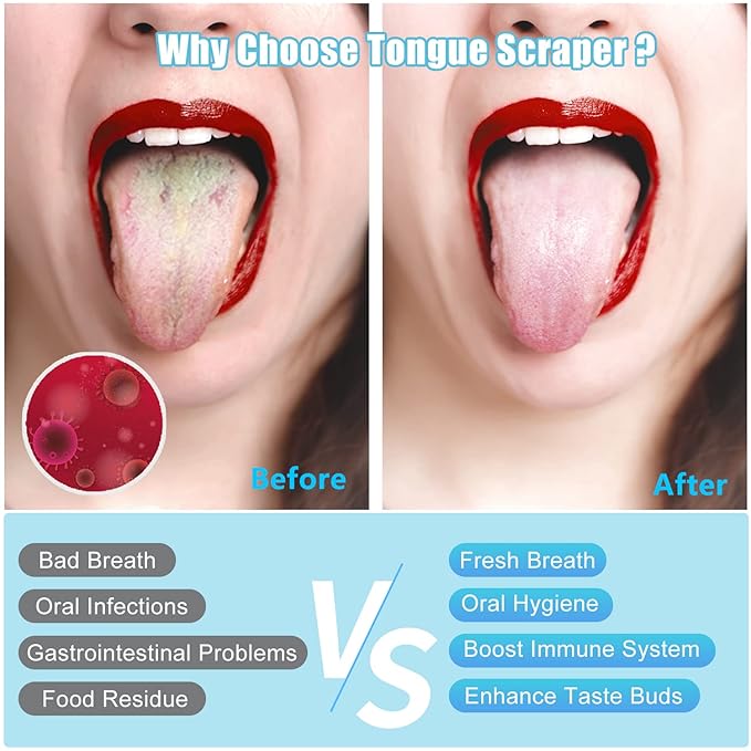 MORGLES Metal Tongue Scraper, 4Pcs Tongue Cleaners for Adults with Portable Case