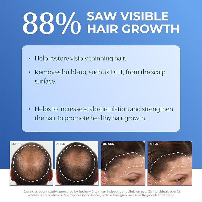 BosleyMD BOSRevive Volumizing Hair System for Non Color-Treated Hair – DHT-Blocking Shampoo, Conditioner & Thickening Treatment – Helps Restore & Thicken Visibly Thinning Hair Starter Size (30 Days)