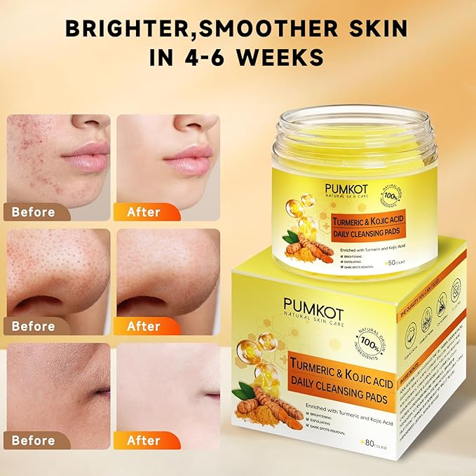 Turmeric Kojic Acid Cleansing Pads, Turmeric Face Scrub Pads Enriched with Kojic Acid, 80PCS