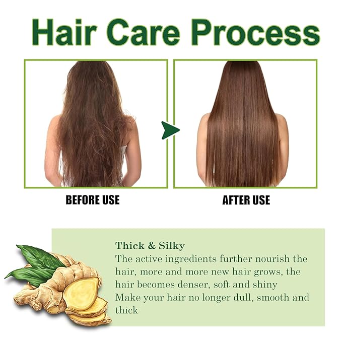 10ml Hair Growth Serum for Thinning Hair – Anti Hair Loss Treatment with Ginseng & Ginger Extract to Stimulate Follicles and Promote Denser, Stronger Hair