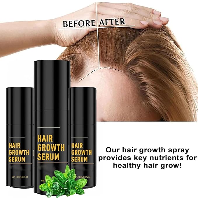 Hair Growth, Hair Growth Spray, Promotes Thicker, Fuller Hair For Women & Men – All Hair Types (2pcs)