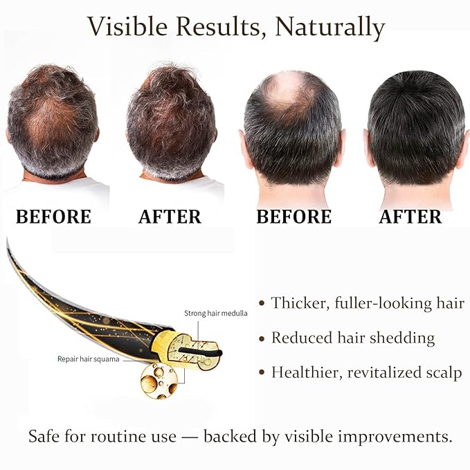 Hair Regrowth System – Advanced Hair Growth Treatment with Ginseng, Eclipta Prostrata, Peppermint Oil & Ginger Root, Thickening Serum for Men & Women (2)