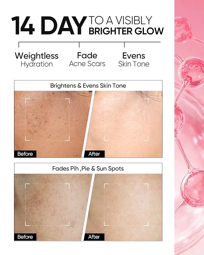 MSH Niacinamide Brightening Cream,Fades Dark Spots, Evens Skin Tone, Tranexamic Acid, α-Arbutin, 5X Ceramides, Centella Asiatica, Suitable for Oil and Acne-prone skin, 2.67 fl.oz / 80g