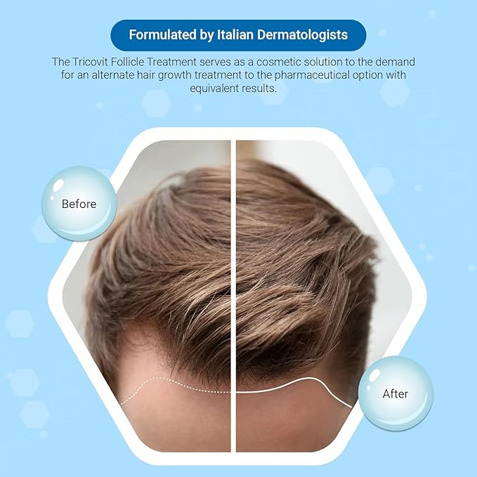 Tricovit Forte Hair Loss Treatment - Hair Growth Products for Women & Men - Sebum Regulator for Strengthening Follicles & Balancing Scalp (5 ct)