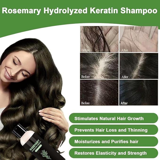 Rosemary Hair Growth Shampoo,Rosemary Hydrolyzed Keratin Shampoo, Nourishes and Regenerates Hair for Thinning Hair & Hair Loss for Women and Men-200Ml*2Pcs