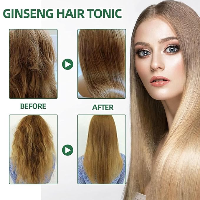 Hair Growth Spray, Para El Crecimiento Del Cabello, Natural Herbs Ginseng Hair Regrowth Serum (3Pcs)