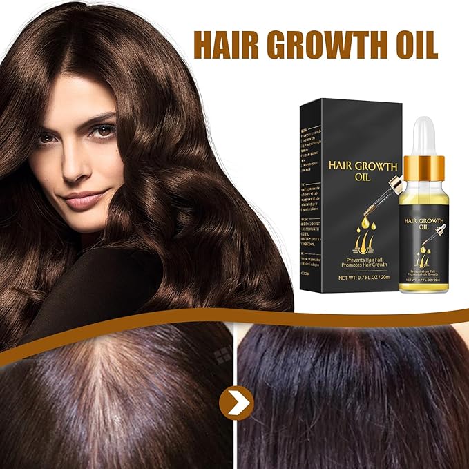 20ml Hair Growth Oil for Thinning Hair – Stimulates Hair Regrowth, Reduces Hair Fall & Boosts Volume with Rosemary & Ginger Extract