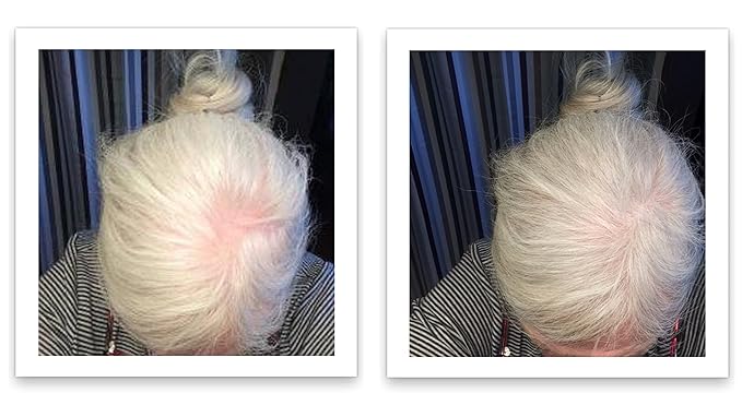 Caboki Hair Building Fiber + Built-in Spray Applicator (30-50 Days Supply). Silver/White
