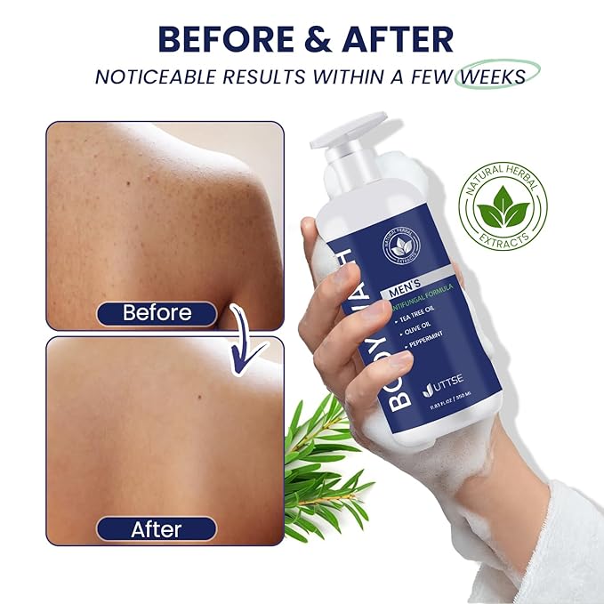 Tea Tree Body Wash: Antifungal Soap for Men - Eliminates Body Odors & Skin Irritations - 11.8fl oz/350mL
