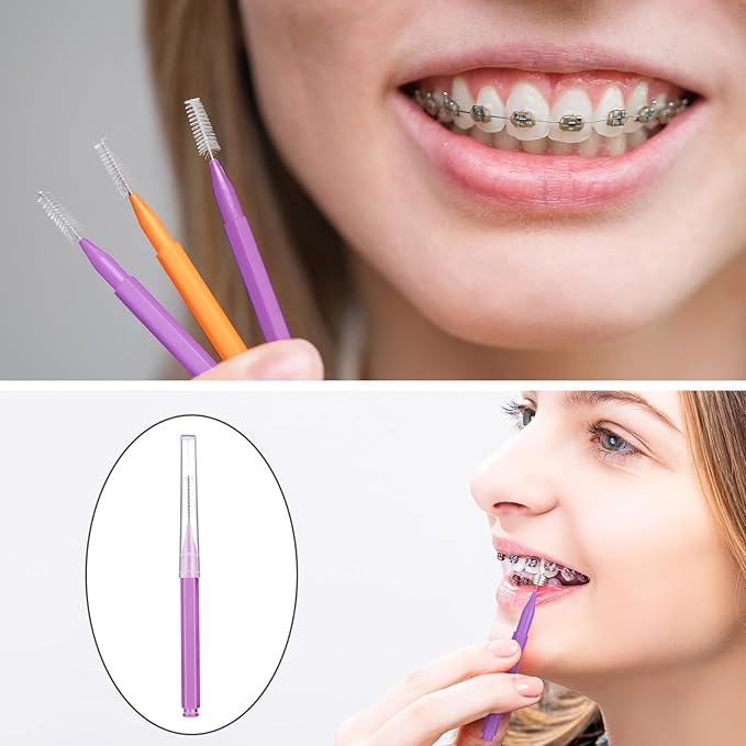 Patelai 100 Pieces Braces Brush for Cleaner Interdental Brush Toothpick Dental Tooth Flossing Head Oral Dental Hygiene Flosser Toothpick Cleaners Tooth Tool(Purple, Orange,Cute Size)