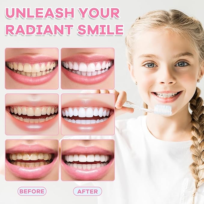 Niacinamide Whitening Toothpaste, Niacinamide Intensive Whitening Toothpaste, Enamel Protection & Long-Lasting Fresh Breath, Stain Removal - Daily Use for Improves Gum Health, Deep Cleaning Care (1)