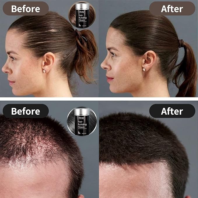 Hair Fibers for Thinning Hair (Medium Brown) - Hair Thickener for Fine Hair for Women & Men - Conceals Hair Loss in 15 Sec - 22gr Bottle