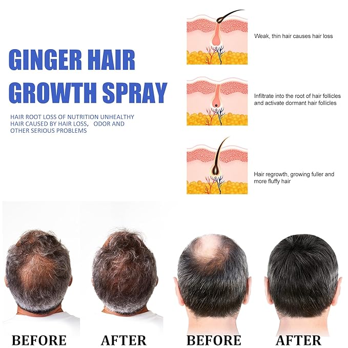 Ginger Hair Growth Spray for Men & Women, 30ml Anti-Hair Loss Treatment, Scalp Nourishing & Follicle Activation, Natural Ginger Extract for Thicker & Fuller Hair