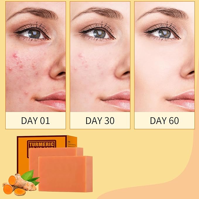 Turmeric Kojic Acid Soap Bar, Kojic Acid Soap for Face Body Hands, Deep Cleansing Natural Curcuma Bath Soaps Bar, Facial Cleanser Body Wash for Acne Blemish 2 Bars- 7OZ